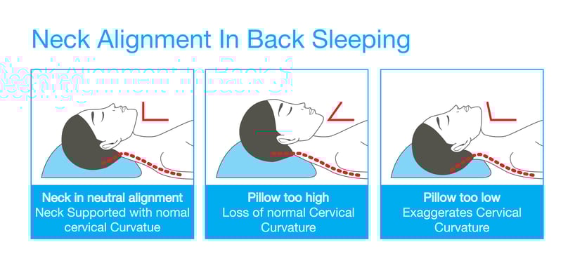 Forward Head Posture Pillow - Cervical Pillow For Forward Head Posture